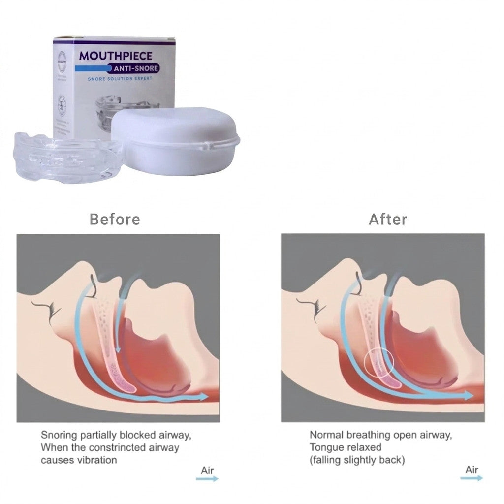 Anti-snoring and teeth grinding mouthguards